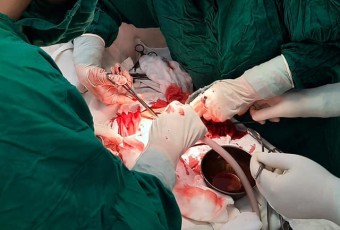 Trung tâm Y tế Việt Yên kịp thời cứu sống sản phụ chửa ngoài tử cung có nhóm máu hiếm AB+