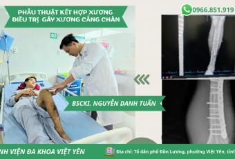 TỪ LO LẮNG ĐẾN TIN TƯỞNG: HÀNH TRÌNH 10 NGÀY HỒI PHỤC CỦA BỆNH NHÂN GÃY XƯƠNG CẲNG CHÂN