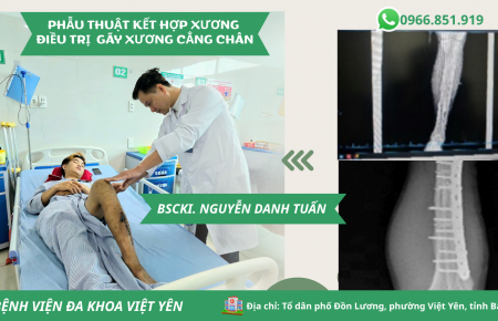 TỪ LO LẮNG ĐẾN TIN TƯỞNG: HÀNH TRÌNH 10 NGÀY HỒI PHỤC CỦA BỆNH NHÂN GÃY XƯƠNG CẲNG CHÂN