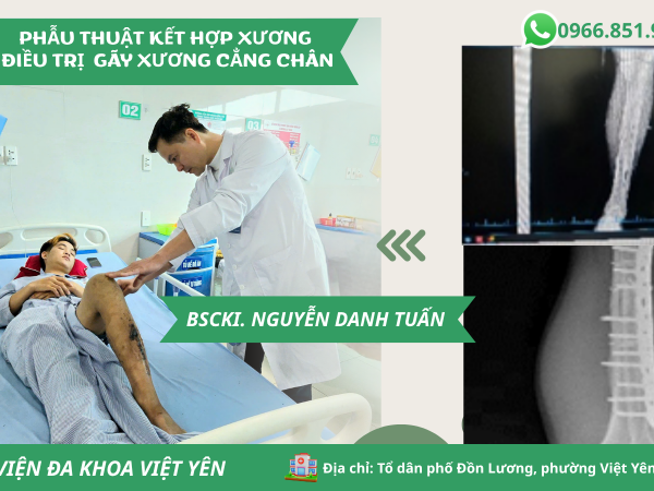 TỪ LO LẮNG ĐẾN TIN TƯỞNG: HÀNH TRÌNH 10 NGÀY HỒI PHỤC CỦA BỆNH NHÂN GÃY XƯƠNG CẲNG CHÂN