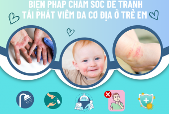 Biện pháp chăm sóc để tránh tái phát viêm da cơ địa ở trẻ em