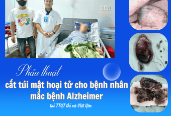 Phẫu thuật nội soi cắt túi mật cho bệnh nhân mắc bệnh Alzheimer
