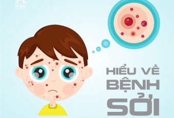 Những điều cần biết về bệnh sởi và cách phòng bệnh