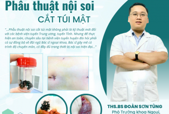 PHẪU THUẬT NỘI SOI CẮT TÚI MẬT THÀNH CÔNG CHO BỆNH NHÂN 17 TUỔI